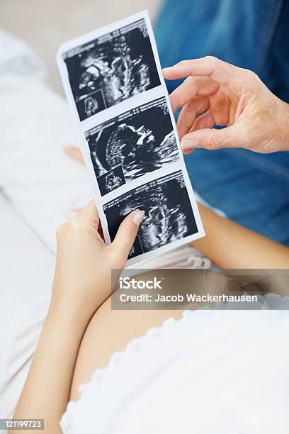 Foto de Detalhe De Um Casal Com Seus Unborn Sonogram Criança e mais fotos de stock de Abdômen Humano