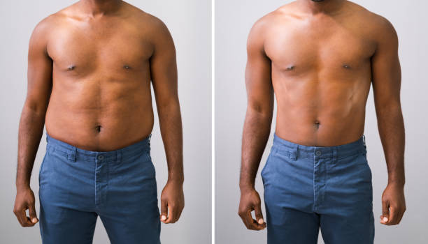 hombre antes y después de la pérdida de peso - torso fotografías e imágenes de stock