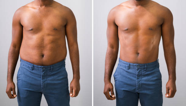 man before and after weight loss - torso imagens e fotografias de stock