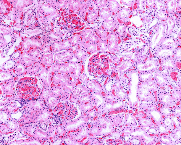 istock Human kidney. Congestion 1212353226
