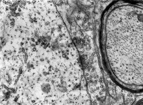 Transmission electron microscope (TEM) micrograph showing two synapses with clear synaptic vesicles. The postsynaptic element (a dendrite) shows ribosomes and cisternae of rough endoplasmic reticulum