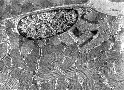 Transmission electron micrograph (TEM) showing a striated skeletal muscle cell in cross section. Among myofibrils (sectioned at the band A level), mitochondria and sarcoplasmic reticulum can be seen.