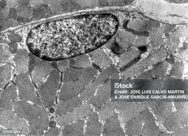 Tem Insect Nuscle Striated Skeletal Muscle Cell Tem Micrograph Stock Photo - Download ...