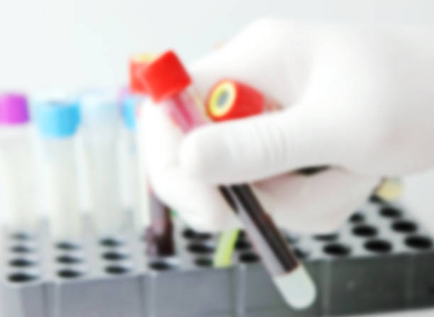 istock Image of Coronavirus disease (COVID-19) 1212390138