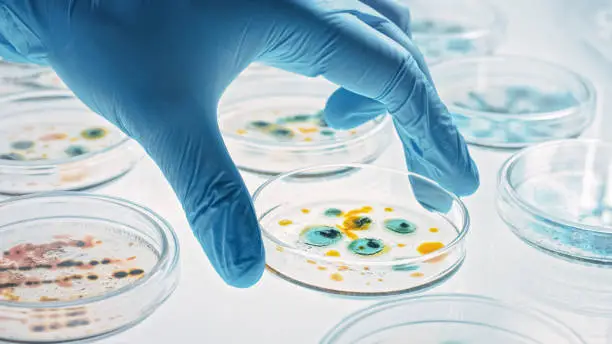 Photo of Scientist Works with Petri Dishes with Various Bacteria, Tissue and Blood Samples. Concept of Pharmaceutical Research for Antibiotics, Curing Disease with DNA Enhancing Drugs. Moving Close-up Macro