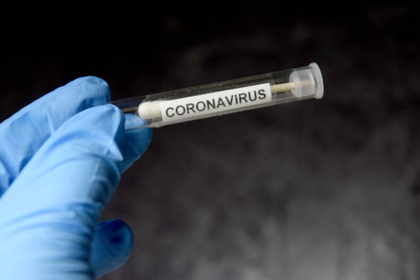coronavirus - specimen holder fotos fotografías e imágenes de stock
