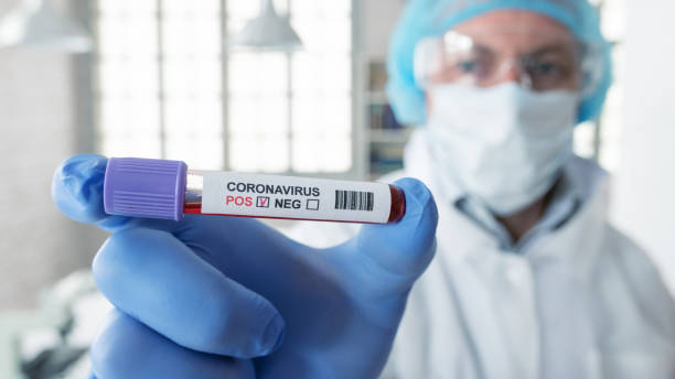 coronavirus blood test in hospital laboratory - technology research analyzing bacterium imagens e fotografias de stock