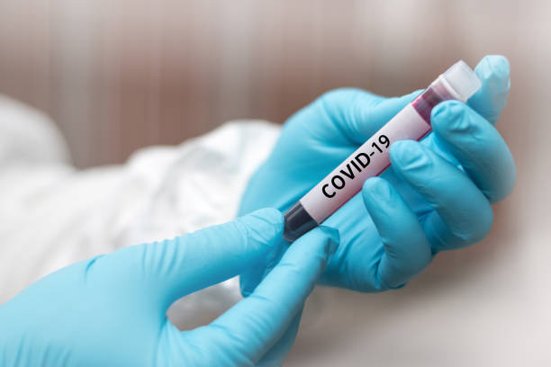 covid-19 named by who for novel coronavirus ncp concept. doctor or lab technician in ppe suit holding blood sample with novel (new) coronavirus  in wuhan, hubei province, china, medical and healthcare - technology research analyzing bacterium imagens e fotografias de stock