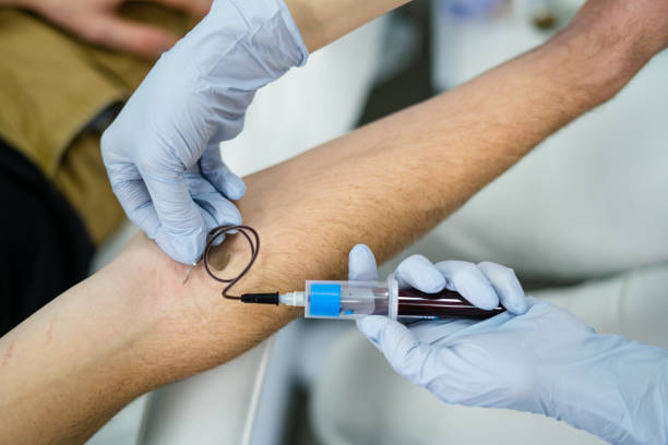 istock TAKING BLOOD IN A TEST FROM A MAN 1212566547