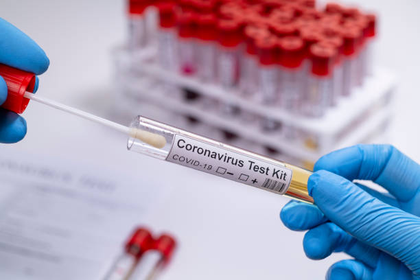 istock Coronavirus COVID 19 test novel corona virus 1212566919