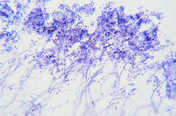 ramas de penicillium, hongos asconcetosos bajo el microscopio - penicillium fotografías e imágenes de stock