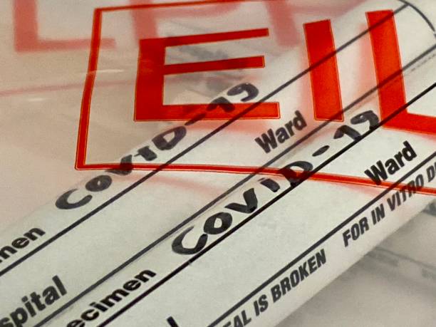 istock Coronavirus CoV-19 medical swab 1212610939
