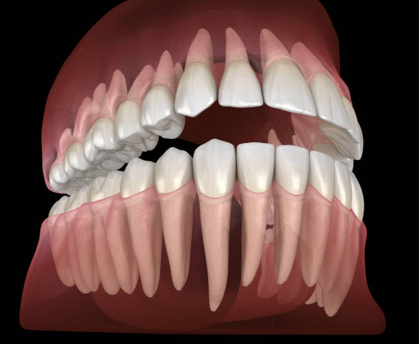 istock Morphology of human teeth. Medically accurate tooth 3D illustration 1212638792