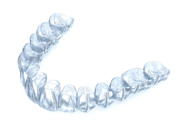 istock Invisalign braces or invisible retainer on white. Medically accurate dental 3D illustration 1212638864
