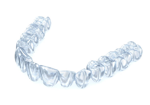 istock Invisalign braces or invisible retainer on white. Medically accurate dental 3D illustration 1212638883