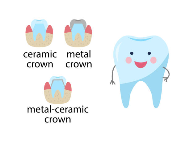 Service installation of a ceramic crown. Service installation of a ceramic crown. As well as a metal and gold crown on the tooth. Happy healthy tooth character. Set icons flat style. dental gold crown stock illustrations
