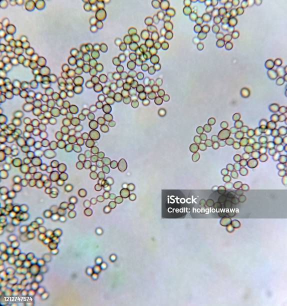 estoy enfermo dulce Migración Esporas De Penicillium Bajo Microscopio Foto de stock y más banco de  imágenes de Microscopio - Microscopio, Bacteria, Debajo de - iStock