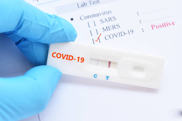 istock Positive test result by using rapid test device for COVID-19 1212766373