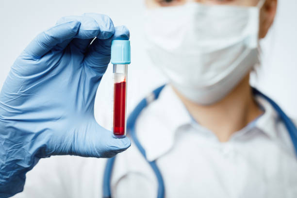 Doctor holding blood test tube stock photo
