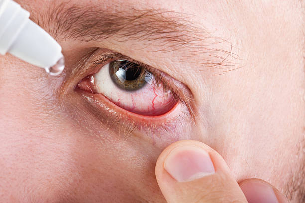 istock Medicine eyedropper 121279536