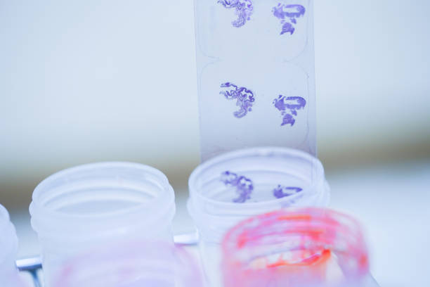 istock Scientist is preparing a tumor slide. Microscopy of cytopathology slides and pathology. 1212840976