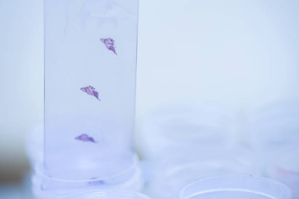 istock Scientist is preparing a tumor slide. Microscopy of cytopathology slides and pathology. 1212840992