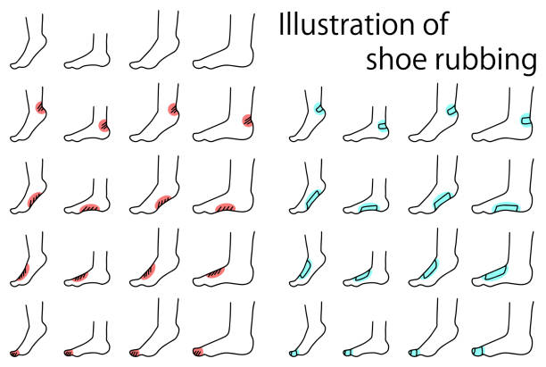 векторный иллюстрации набора трения обуви (цвет)3 - butterfly bandage stock illustrations