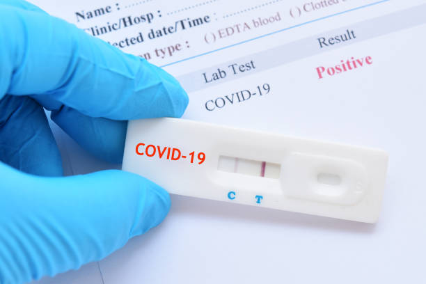 istock Positive test result by using rapid test device for COVID-19 virus 1212988263