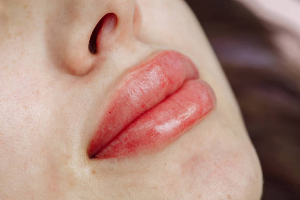 istock Lips after permanent makeup in beauty salon 1213194904