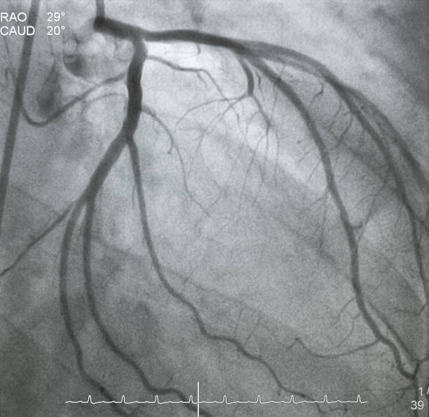 冠動脈造影 - surgery catheter cardiac catheterization hospital ストックフォトと画像