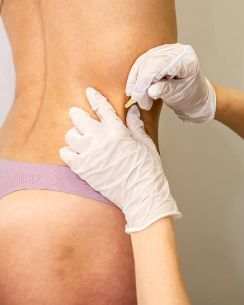 istock Doctor doing Injection into female beautiful body. 1213236395