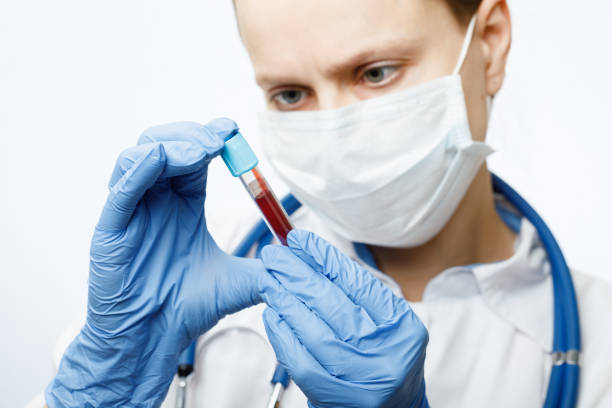 doctor holding blood test tube - blood sample imagens e fotografias de stock