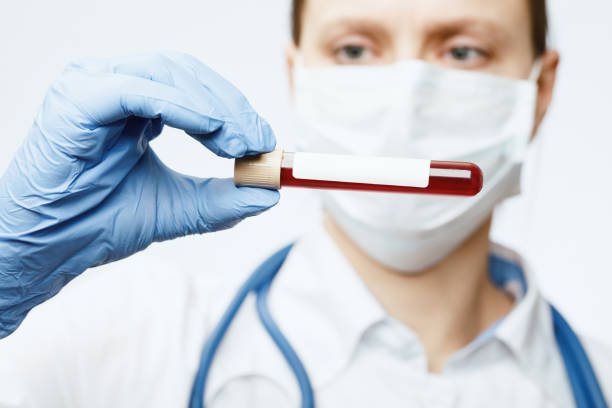 doctor holding blood test tube - blood sample imagens e fotografias de stock