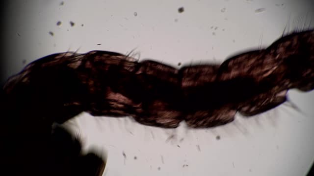 Larva mosquito Chironomidae moves in dirty water close-up in microscope