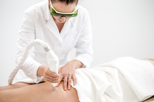 Dermatólogo Extracción de Venas Vasculares en pierna de la mujer con tratamiento láser - foto de stock photo