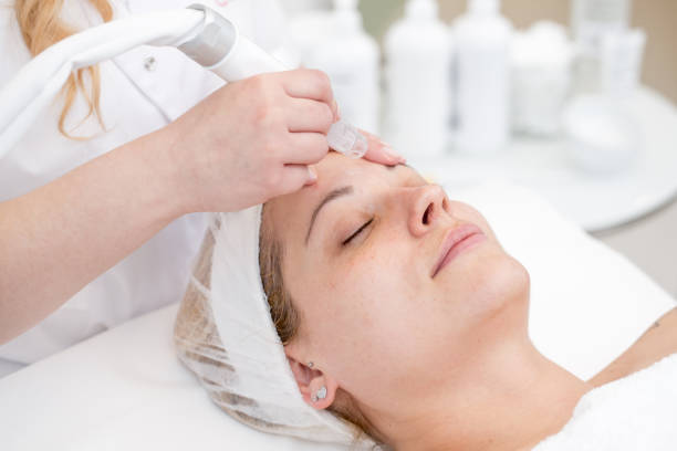 Adult Woman at Microdermabrasion Treatment Adult Woman at Microdermabrasion Treatment microdermabrasion stock pictures, royalty-free photos & images