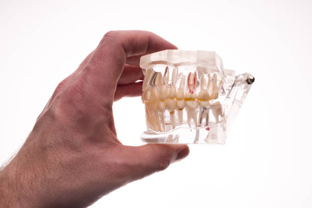 istock Dentist holding dentures jaw layout on a white background 1213421742