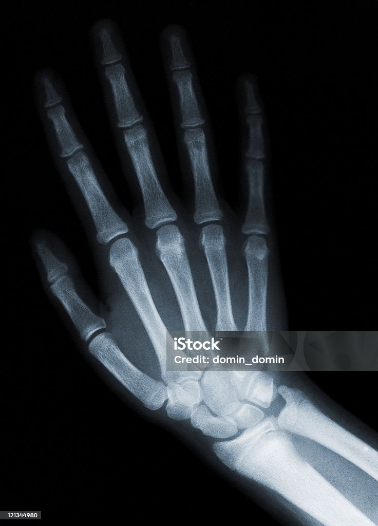 Mano derecha - Foto de stock de Articulación humana libre de derechos