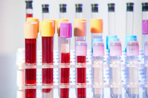 istock Test tubes. Medical equipment. 1213485058