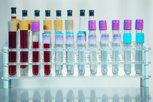 istock Test tubes. Medical equipment. 1213485328