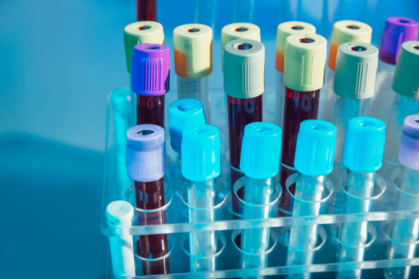 istock Test tubes. Medical equipment. 1213485540
