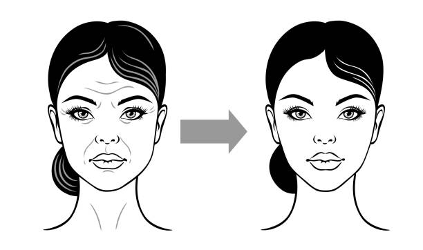 ilustrações de stock, clip art, desenhos animados e ícones de woman face before and after facelift, anti-aging. vector illustration on a white background. - wrinkled