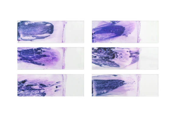 set di scivoli di vetro dopo biopsia di aspirazione dell'ago fine tiroidea, diapositive biopsia tissutale per istologia - vetrino per microscopio foto e immagini stock