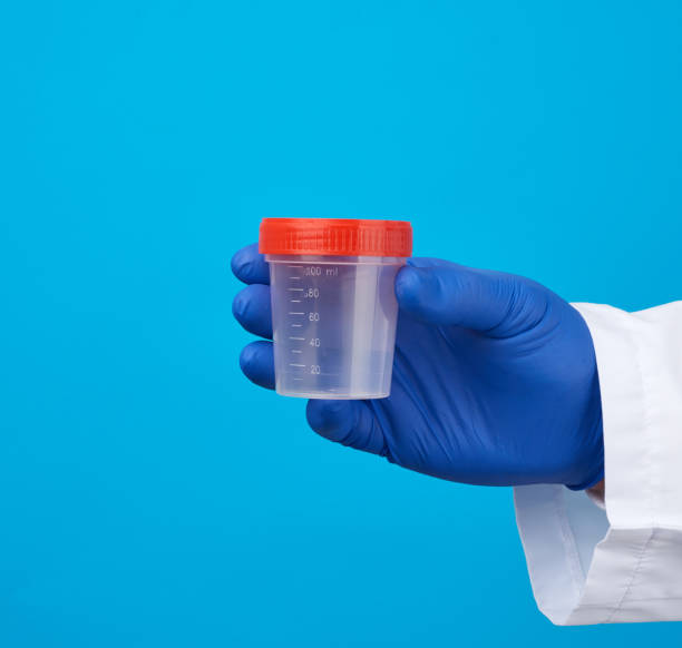 istock male doctor in a white coat holds a empty plastic container for urine specimen 1213579146
