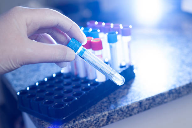 istock Coagulation tube in lights 1213583599