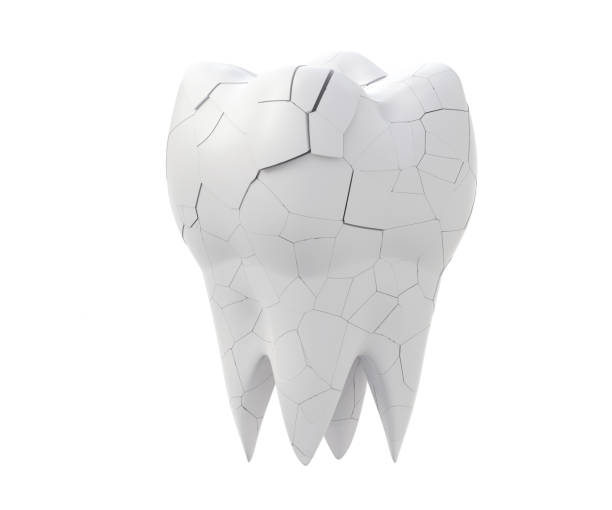 istock Broken molars tooth and whole tooth isolated on white background 1213678034