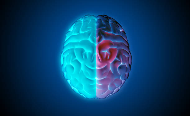 istock 3D rendering brain top view blue on left and colorful red on right 1213769722