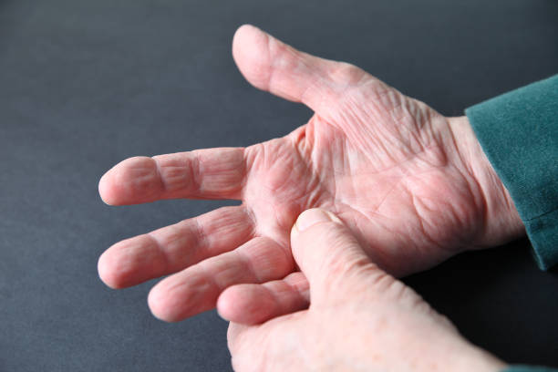 istock Man has pain in his hand with copy space 1213890901