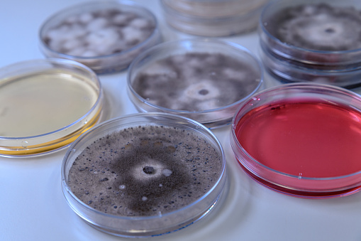 Microbiological culture in a petri dish for pharmaceutical bioscience research. Concept of science, laboratory and study of diseases. Coronavirus (COVID-19) treatment developing.