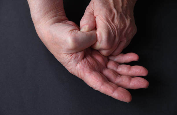 istock Senior man with thumb joint inflammation 1213899581